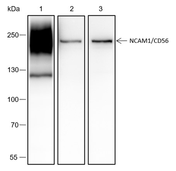 NCAM Recombinant Rabbit Monoclonal Antibody
