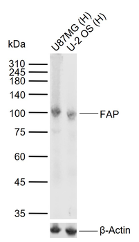 FAP Recombinant Rabbit Monoclonal Antibody