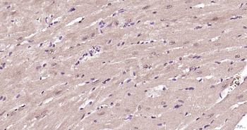 CSEN Rabbit Polyclonal Antibody