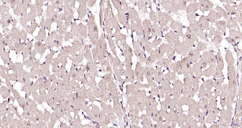 CSEN Rabbit Polyclonal Antibody