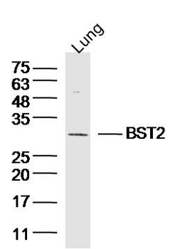 BST2 Rabbit Polyclonal Antibody