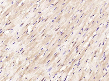 Phospho-cardiac Troponin I (Thr143) Rabbit Polyclonal Antibody