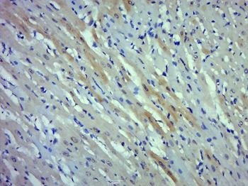 Phospho-cardiac Troponin I (Thr143) Rabbit Polyclonal Antibody
