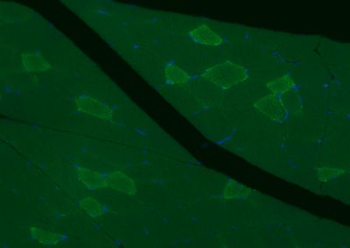 MYH7 Rabbit Polyclonal Antibody