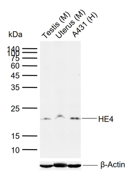 HE4 Recombinant Rabbit Monoclonal Antibody