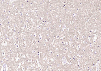 Alpha Synuclein Recombinant Rabbit Monoclonal Antibody