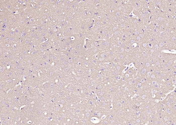 Alpha Synuclein Recombinant Rabbit Monoclonal Antibody