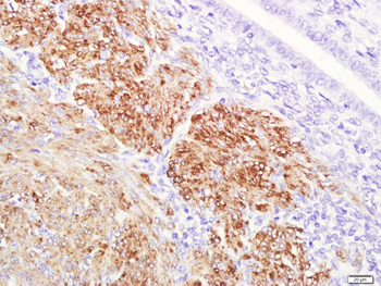 Actin, alpha skeletal muscle Mouse Monoclonal Antibody