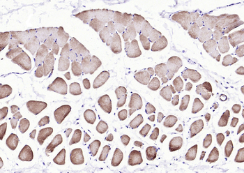 Actin, alpha skeletal muscle Mouse Monoclonal Antibody
