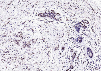 Phospho-PTPN11 (Tyr511) Rabbit Polyclonal Antibody