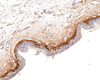 Periostin Recombinant Rabbit Monoclonal Antibody