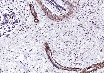 Peripherin Rabbit Polyclonal Antibody