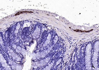 Peripherin Rabbit Polyclonal Antibody
