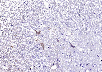 Peripherin Rabbit Polyclonal Antibody