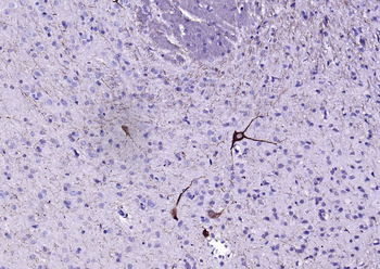 Peripherin Rabbit Polyclonal Antibody