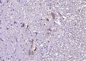 Peripherin Rabbit Polyclonal Antibody