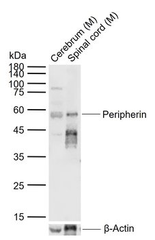 Peripherin Rabbit Polyclonal Antibody