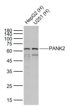 PANK2 Rabbit Polyclonal Antibody