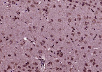 UBE2I Rabbit Polyclonal Antibody