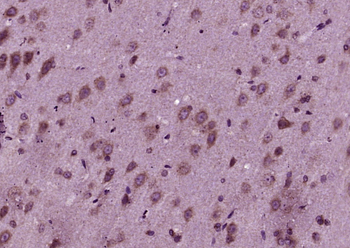 UBE2I Rabbit Polyclonal Antibody