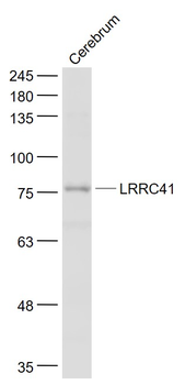 LRRC41 Rabbit Polyclonal Antibody