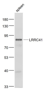 LRRC41 Rabbit Polyclonal Antibody