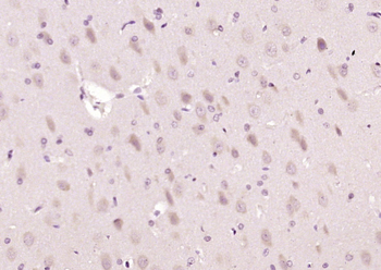 C1QL1 Rabbit Polyclonal Antibody