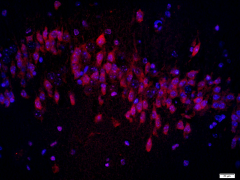 Osteocalcin Rabbit Polyclonal Antibody