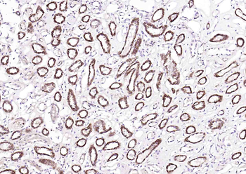 Osteocalcin Rabbit Polyclonal Antibody