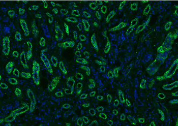 Osteocalcin Rabbit Polyclonal Antibody