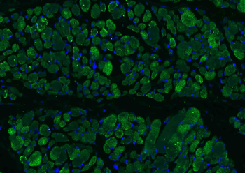 Osteocalcin Rabbit Polyclonal Antibody