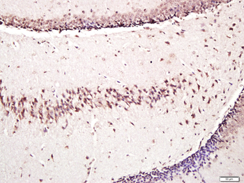 Osteocalcin Rabbit Polyclonal Antibody