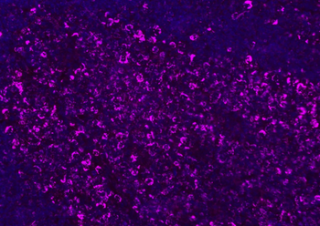 CD8B Rabbit Polyclonal Antibody