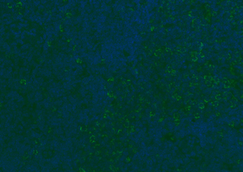 CD8B Rabbit Polyclonal Antibody