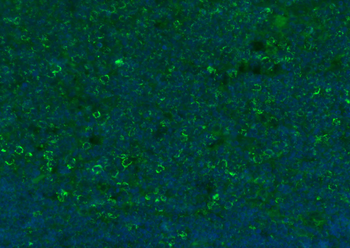 CD8B Rabbit Polyclonal Antibody