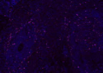 CD8B Rabbit Polyclonal Antibody