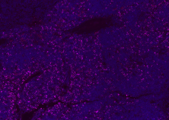 CD8B Rabbit Polyclonal Antibody