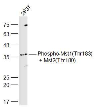 Phospho-Mst1 (Thr183) + Mst2 (Thr180) Rabbit Polyclonal Antibody