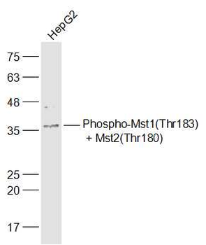 Phospho-Mst1 (Thr183) + Mst2 (Thr180) Rabbit Polyclonal Antibody