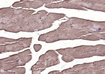 Phospho-MAPKAPK2 (Ser272) Rabbit Polyclonal Antibody