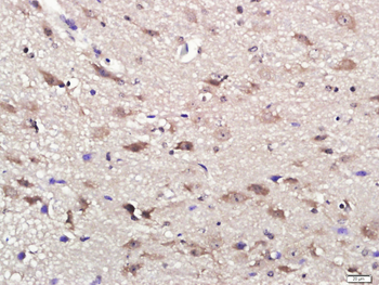Phospho-RPS6KA1 (Thr573) Rabbit Polyclonal Antibody