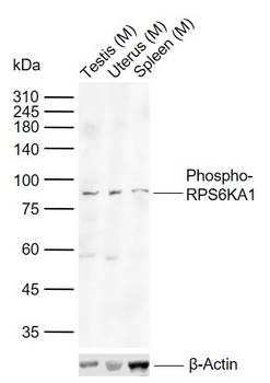 Phospho-RPS6KA1 (Thr573) Rabbit Polyclonal Antibody