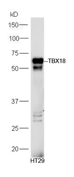 TBX18 Rabbit Polyclonal Antibody