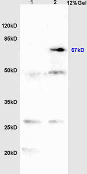 TBX18 Rabbit Polyclonal Antibody