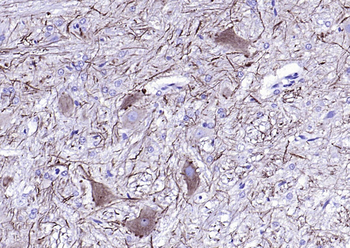NF-L Mouse Monoclonal Antibody