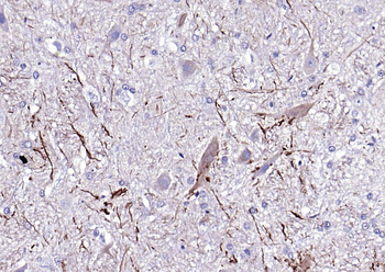 NF-L Mouse Monoclonal Antibody