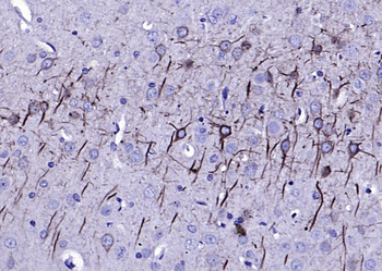 NF-L Mouse Monoclonal Antibody