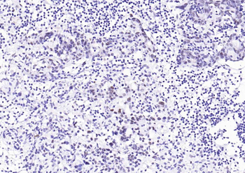 MRE11 Recombinant Rabbit Monoclonal Antibody