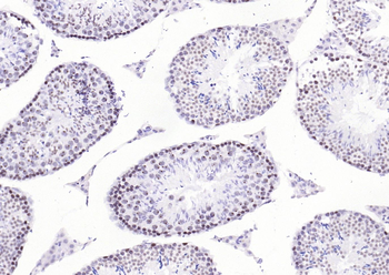 MRE11 Recombinant Rabbit Monoclonal Antibody