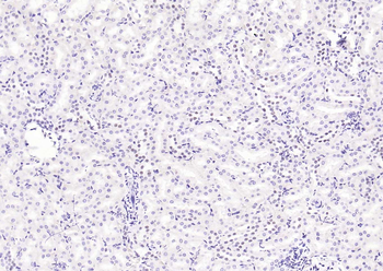 MRE11 Recombinant Rabbit Monoclonal Antibody